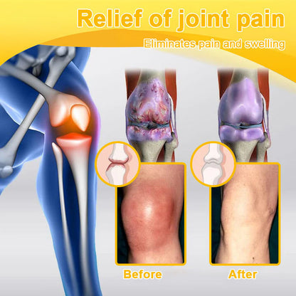 Official U.S Store ✨Purelora® Bee Venom Pain Relief Joint Repair Cream 🐝🐝(Fast Acting Pain Relief, Inflammation Reduction & Bone Support)