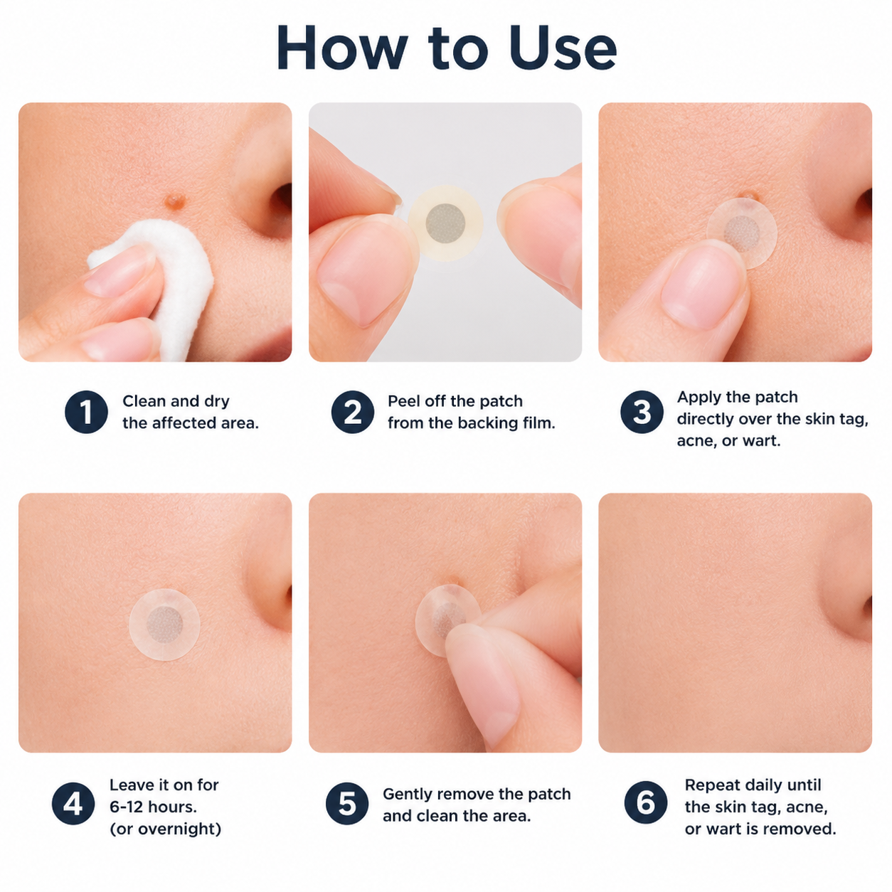 🩹Curalona®2-in-1 Microneedle & Hydrocolloid Patch🍀| Removes Raised Moles, Acne, Flat Warts & Skin Tags | Helps Improve Wrinkles, Scars & Blemishes | Invisible Patches for Face & Body