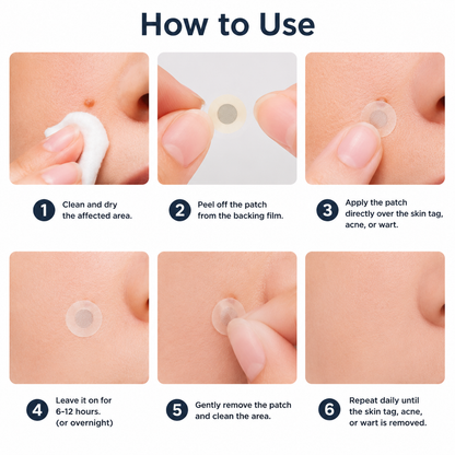 🩹Curalona®2-in-1 Microneedle & Hydrocolloid Patch🍀| Removes Raised Moles, Acne, Flat Warts & Skin Tags | Helps Improve Wrinkles, Scars & Blemishes | Invisible Patches for Face & Body