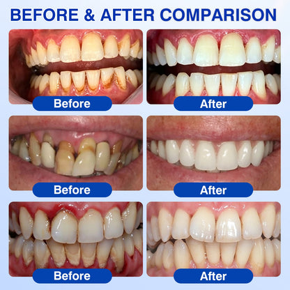 🇺🇸🏅🦷🛡️Purelora® GumRevive Periodontal Repair Gel