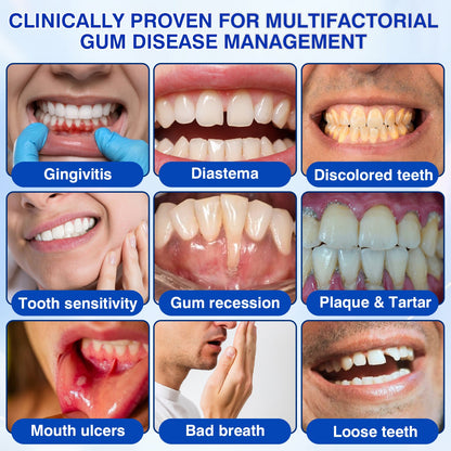 🇺🇸🏅🦷🛡️Purelora® GumRevive Periodontal Repair Gel