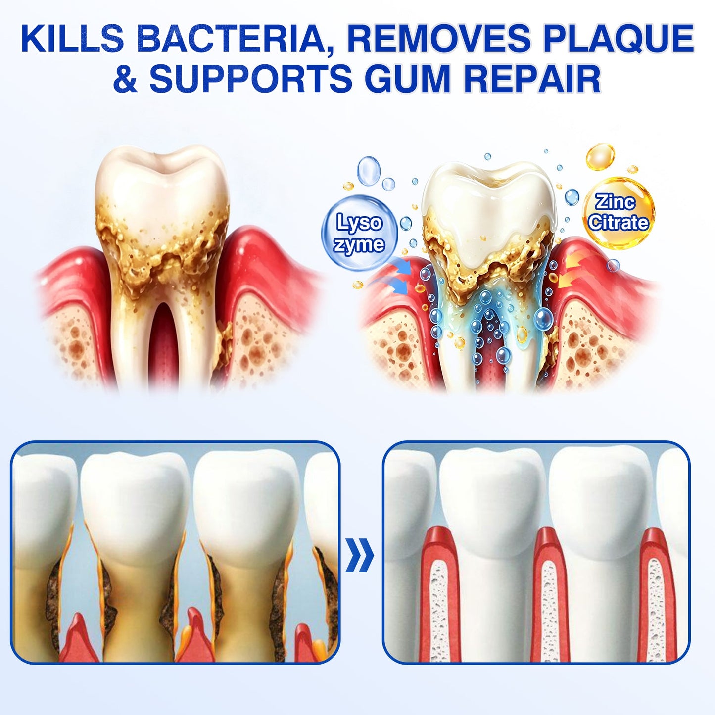 🇺🇸🏅🦷🛡️Purelora® GumRevive Periodontal Repair Gel