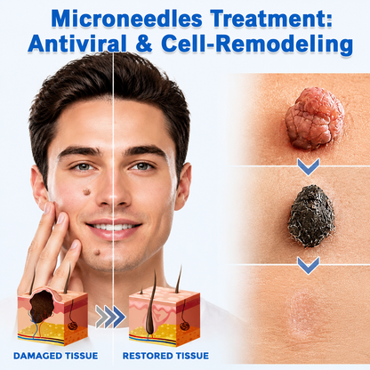 🩹Curalona®2-in-1 Microneedle & Hydrocolloid Patch🍀| Removes Raised Moles, Acne, Flat Warts & Skin Tags | Helps Improve Wrinkles, Scars & Blemishes | Invisible Patches for Face & Body