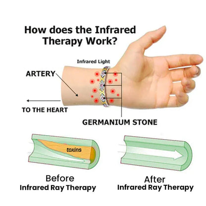 🔥LAST DAY SALE-80% OFF🔥 – Germanium Lymphvity Detox Bracelet