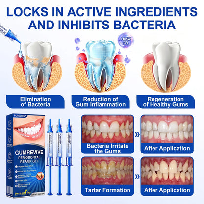 🇺🇸🏅🦷🛡️Purelora® GumRevive Periodontal Repair Gel